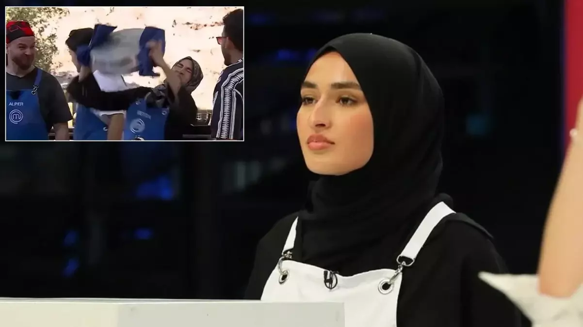 Masterchef’te yüzü yanan Beyza’nın son hali